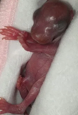 Ein neugeborenes, rötlich-nacktes Eichhörnchen liegt auf einem weißen Handtuch.